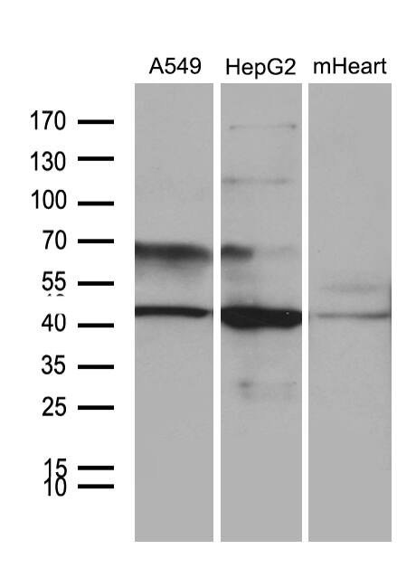 Western blot analysis of extracts (35ug) from 2 different cell lines and mouse heart tissue lysate by using anti-FBXO22 monoclonal antibody (1:500).