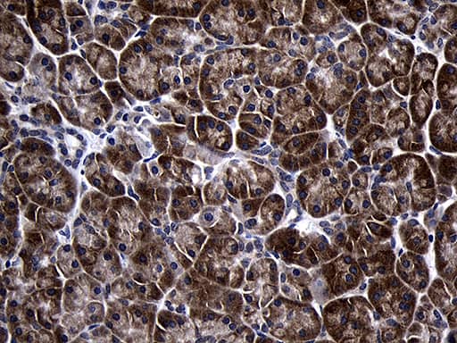 Immunohistochemistry TIN2 Antibody (OTI2C12)