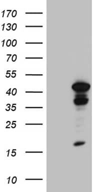 Western Blot TIN2 Antibody (OTI2C12)