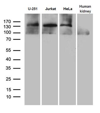 Western blot analysis of extracts (35ug) from 3 different cell lines and human kidney tissue lysate by using anti-SUPT16H monoclonal antibody (1:500).