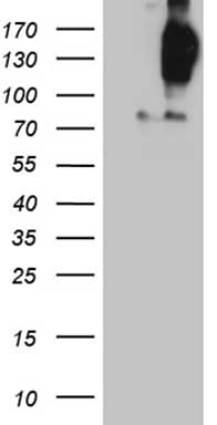 HEK293T cells were transfected with the pCMV6-ENTRY control (Left lane) or pCMV6-ENTRY FYCO1 (, Right lane) cDNA for 48 hrs and lysed. Equivalent amounts of cell lysates (5 ug per lane) were separated by SDS-PAGE and immunoblotted with anti-FYCO1 (1:2000). 