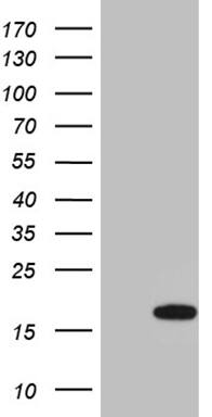 HEK293T cells were transfected with the pCMV6-ENTRY control ( Left lane) or pCMV6-ENTRY VPREB3 ( Right lane) cDNA for 48 hrs and lysed. Equivalent amounts of cell lysates (5 ug per lane) were separated by SDS-PAGE and immunoblotted with anti-VPREB3 (1:2000). Positive lysates