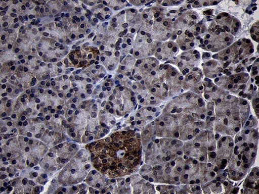 Immunohistochemical staining of paraffin-embedded Human pancreas tissue within the normal limits using anti-USP40 mouse monoclonal antibody. Heat-induced epitope retrieval by EDTA solution buffer pH 8.0 at 120Â°C for 3 min.