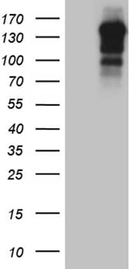 HEK293T cells were transfected with the pCMV6-ENTRY control ( Left lane) or pCMV6-ENTRY USP40 ( Right lane) cDNA for 48 hrs and lysed. Equivalent amounts of cell lysates (5 ug per lane) were separated by SDS-PAGE and immunoblotted with anti-USP40(1:2000). Positive lysates