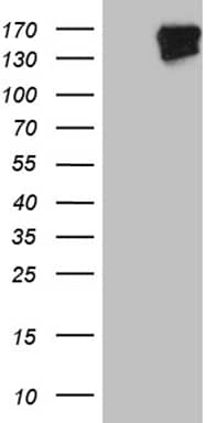 HEK293T cells were transfected with the pCMV6-ENTRY control ( Left lane) or pCMV6-ENTRY FYCO1 ( Right lane) cDNA for 48 hrs and lysed. Equivalent amounts of cell lysates (5 ug per lane) were separated by SDS-PAGE and immunoblotted with anti-FYCO1(1:2000). Positive lysates