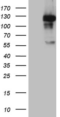 HEK293T cells were transfected with the pCMV6-ENTRY control (Left lane) or pCMV6-ENTRY MAPK8IP1 (, Right lane) cDNA for 48 hrs and lysed. Equivalent amounts of cell lysates (5 ug per lane) were separated by SDS-PAGE and immunoblotted with anti-MAPK8IP1 (1:2000). 
