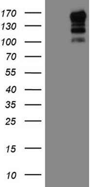 HEK293T cells were transfected with the pCMV6-ENTRY control (Left lane) or pCMV6-ENTRY USP40 (, Right lane) cDNA for 48 hrs and lysed. Equivalent amounts of cell lysates (5 ug per lane) were separated by SDS-PAGE and immunoblotted with anti-USP40 (1:2000). 