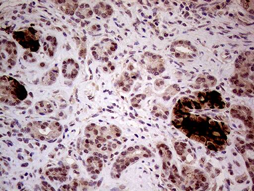 Immunohistochemical staining of paraffin-embedded Human pancreas tissue within the normal limits using anti-INPP5F mouse monoclonal antibody. Heat-induced epitope retrieval by EDTA solution buffer pH 8.0 at 120Â°C for 3 min.