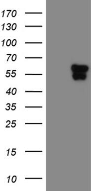 HEK293T cells were transfected with the pCMV6-ENTRY control ( Left lane) or pCMV6-ENTRY TEKT2 ( Right lane) cDNA for 48 hrs and lysed. Equivalent amounts of cell lysates (5 ug per lane) were separated by SDS-PAGE and immunoblotted with anti-TEKT2 (1:2000). Positive lysates