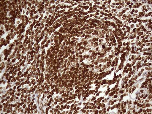 Immunohistochemical staining of paraffin-embedded Human lymph node tissue within the normal limits using anti-DDX19A mouse monoclonal antibody. Heat-induced epitope retrieval by EDTA solution buffer pH 8.0 at 120Â°C for 3 min.