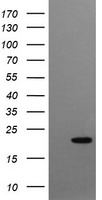 HEK293T cells were transfected with the pCMV6-ENTRY control ( Left lane) or pCMV6-ENTRY CRYGC ( Right lane) cDNA for 48 hrs and lysed. Equivalent amounts of cell lysates (5 ug per lane) were separated by SDS-PAGE and immunoblotted with anti-CRYGC. Positive lysates