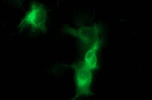 Immunofluorescence:Tyrosine Hydroxylase Antibody (OTI2E6)[NBP3-44859]