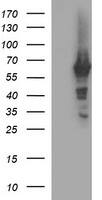HEK293T cells were transfected with the pCMV6-ENTRY control (Left lane) or pCMV6-ENTRY TH (, Right lane) cDNA for 48 hrs and lysed. Equivalent amounts of cell lysates (5 ug per lane) were separated by SDS-PAGE and immunoblotted with anti-TH. 