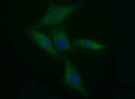 Immunofluoreaining of HeLa cells using anti-TH mouse monoclonal antibody .
