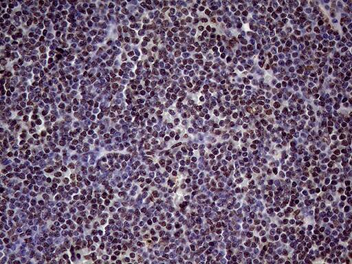 Immunohistochemistry:XRN2 Antibody (OTI5F4)[NBP3-44953]
