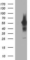 HEK293T cells were transfected with the pCMV6-ENTRY control (Left lane) or pCMV6-ENTRY TH (, Right lane) cDNA for 48 hrs and lysed. Equivalent amounts of cell lysates (5 ug per lane) were separated by SDS-PAGE and immunoblotted with anti-TH. 