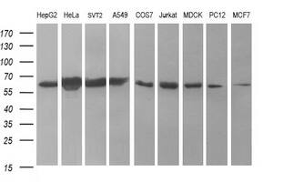 Western blot analysis of extracts (35ug) from 9 different cell lines by using anti-TH monoclonal antibody (HepG2: human; HeLa: human; SVT2: mouse; A549: human; COS7: monkey; Jurkat: human; MDCK: canine; PC12: rat; MCF7: human). Dilution: 1:400