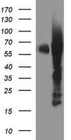 HEK293T cells were transfected with the pCMV6-ENTRY control (Left lane) or pCMV6-ENTRY TH (, Right lane) cDNA for 48 hrs and lysed. Equivalent amounts of cell lysates (5 ug per lane) were separated by SDS-PAGE and immunoblotted with anti-TH. 