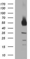 HEK293T cells were transfected with the pCMV6-ENTRY control (Left lane) or pCMV6-ENTRY TH (, Right lane) cDNA for 48 hrs and lysed. Equivalent amounts of cell lysates (5 ug per lane) were separated by SDS-PAGE and immunoblotted with anti-TH. 