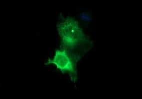 Immunofluorescence:Tyrosine Hydroxylase Antibody (OTI1A4)[NBP3-44864]