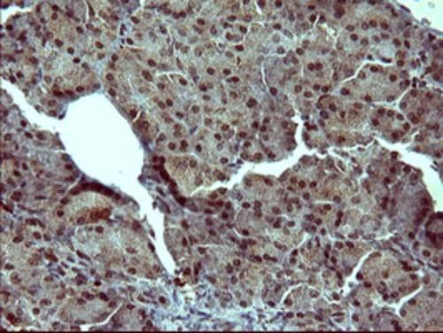 Immunohistochemistry:Tyrosine Hydroxylase Antibody (OTI1A4)[NBP3-44864]