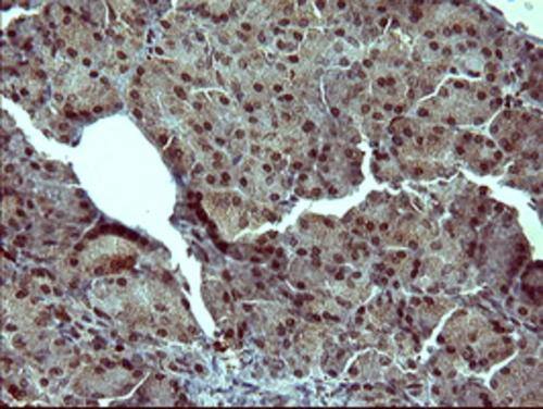Immunohistochemical staining of paraffin-embedded Human pancreas tissue within the normal limits using anti-TH mouse monoclonal antibody. . Heat-induced epitope retrieval by EDTA solution buffer pH 8.0 at 120Â°C for 3 min.