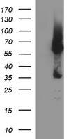 HEK293T cells were transfected with the pCMV6-ENTRY control (Left lane) or pCMV6-ENTRY TH (, Right lane) cDNA for 48 hrs and lysed. Equivalent amounts of cell lysates (5 ug per lane) were separated by SDS-PAGE and immunoblotted with anti-TH. 