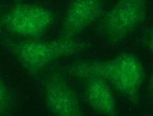 Immunofluoreaining of HeLa cells using anti-TUBB2A mouse monoclonal antibody .