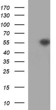 Western Blot:beta II Tubulin Antibody (OTI3B7)[NBP3-44865]