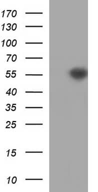 HEK293T cells were transfected with the pCMV6-ENTRY control (Left lane) or pCMV6-ENTRY TUBB2A (, Right lane) cDNA for 48 hrs and lysed. Equivalent amounts of cell lysates (5 ug per lane) were separated by SDS-PAGE and immunoblotted with anti-TUBB2A. 