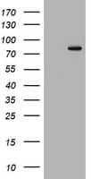 HEK293T cells were transfected with the pCMV6-ENTRY control (Left lane) or pCMV6-ENTRY POLI (, Right lane) cDNA for 48 hrs and lysed. Equivalent amounts of cell lysates (5 ug per lane) were separated by SDS-PAGE and immunoblotted with anti-POLI. 