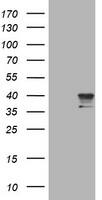 HEK293T cells were transfected with the pCMV6-ENTRY control (Left lane) or pCMV6-ENTRY NEU1 (, Right lane) cDNA for 48 hrs and lysed. Equivalent amounts of cell lysates (5 ug per lane) were separated by SDS-PAGE and immunoblotted with anti-NEU1. 