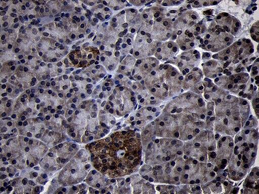 Immunohistochemical staining of paraffin-embedded Human pancreas tissue within the normal limits using anti-USP40 mouse monoclonal antibody. Heat-induced epitope retrieval by EDTA solution buffer pH 8.0 at 120Â°C for 3 min.