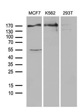Western Blot:USP40 Antibody (OTI2C5)[NBP3-44885]