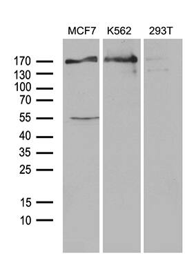 Western blot analysis of extracts (35ug) from 3 different cell lines by using anti-USP40 monoclonal antibody (1:500).