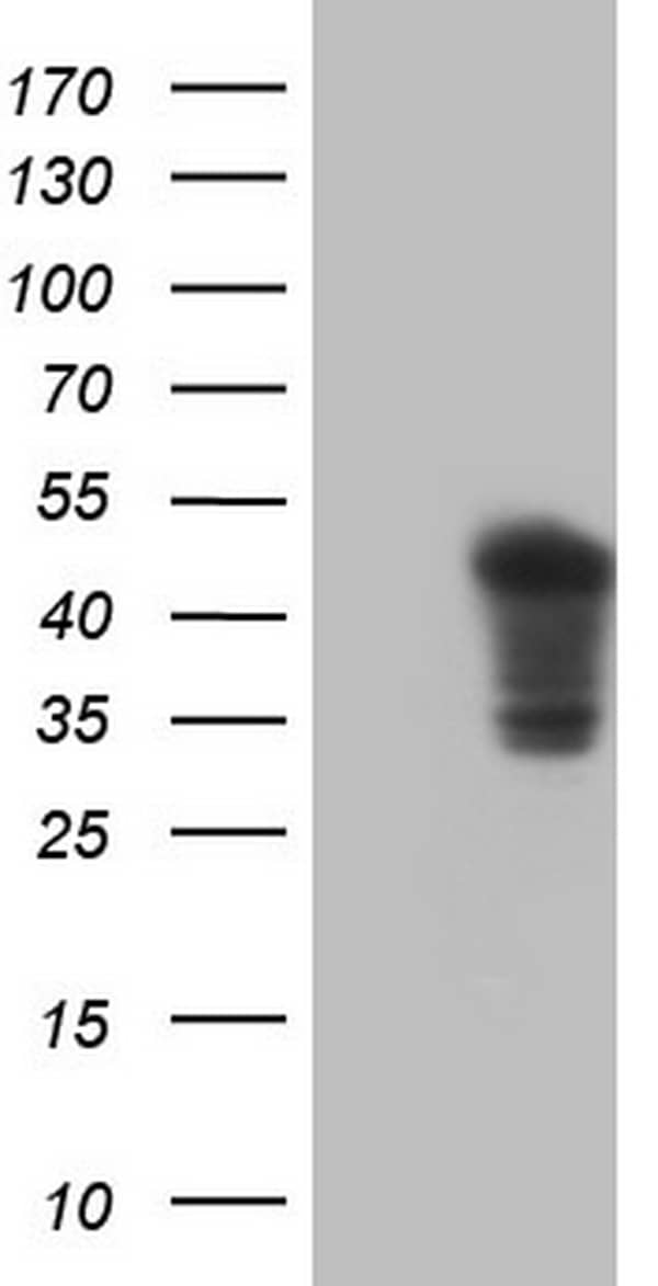 HEK293T cells were transfected with the pCMV6-ENTRY control (Left lane) or pCMV6-ENTRY TNNT2 (, Right lane) cDNA for 48 hrs and lysed. Equivalent amounts of cell lysates (5 ug per lane) were separated by SDS-PAGE and immunoblotted with anti-TNNT2. 