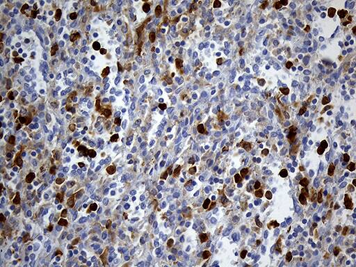 Immunohistochemistry UBE3B Antibody (OTI3F10)