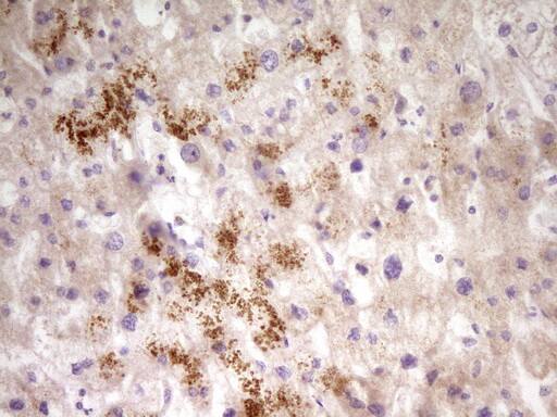 Immunohistochemistry:PAPSS2 Antibody (OTI3H10)[NBP3-44893]
