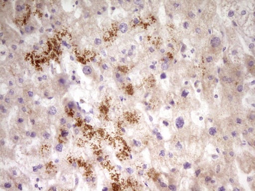 Immunohistochemical staining of paraffin-embedded Human liver tissue within the normal limits using anti-PAPSS2 mouse monoclonal antibody. Heat-induced epitope retrieval by EDTA solution buffer pH 8.0 at 120Â°C for 3 min.