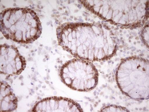 Immunohistochemical staining of paraffin-embedded Human colon tissue within the normal limits using anti-PAPSS2 mouse monoclonal antibody. Heat-induced epitope retrieval by EDTA solution buffer pH 8.0 at 120Â°C for 3 min.