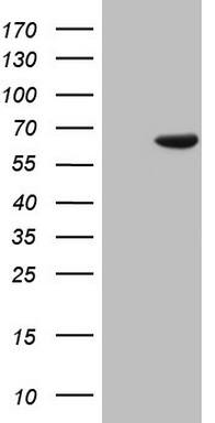 HEK293T cells were transfected with the pCMV6-ENTRY control ( Left lane) or pCMV6-ENTRY PAPSS2 ( Right lane) cDNA for 48 hrs and lysed. Equivalent amounts of cell lysates (5 ug per lane) were separated by SDS-PAGE and immunoblotted with anti-PAPSS2. Positive lysates