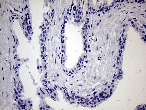 Immunohistochemistry:JIP1 Antibody (OTI1D9)[NBP3-44895]