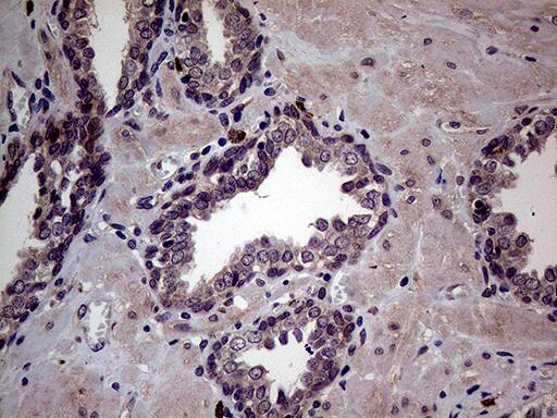 Immunohistochemistry JIP1 Antibody (OTI1D9)