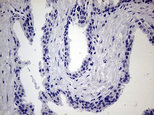 Immunohistochemistry JIP1 Antibody (OTI1D9)
