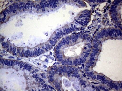 Immunohistochemistry:PAPSS2 Antibody (OTI6H10)[NBP3-44898]