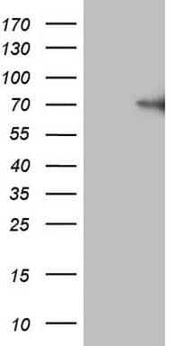 HEK293T cells were transfected with the pCMV6-ENTRY control (Left lane) or pCMV6-ENTRY F12 (, Right lane) cDNA for 48 hrs and lysed. Equivalent amounts of cell lysates (5 ug per lane) were separated by SDS-PAGE and immunoblotted with anti-F12 (1:2000).