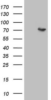 HEK293T cells were transfected with the pCMV6-ENTRY control ( Left lane) or pCMV6-ENTRY F12 ( Right lane) cDNA for 48 hrs and lysed. Equivalent amounts of cell lysates (5 ug per lane) were separated by SDS-PAGE and immunoblotted with anti-F12 (1:500).