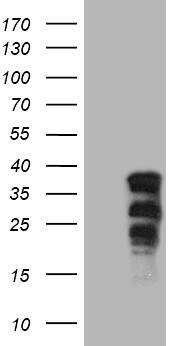 Western Blot:SOX21 Antibody (OTI7D5)[NBP3-44903]
