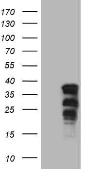 HEK293T cells were transfected with the pCMV6-ENTRY control ( Left lane) or pCMV6-ENTRY SOX21 ( Right lane) cDNA for 48 hrs and lysed. Equivalent amounts of cell lysates (5 ug per lane) were separated by SDS-PAGE and immunoblotted with anti-SOX21(1:2000).
