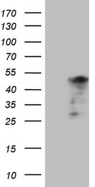 HEK293T cells were transfected with the pCMV6-ENTRY control (Left lane) or pCMV6-ENTRY TNNT2 (, Right lane) cDNA for 48 hrs and lysed. Equivalent amounts of cell lysates (5 ug per lane) were separated by SDS-PAGE and immunoblotted with anti-TNNT2. 